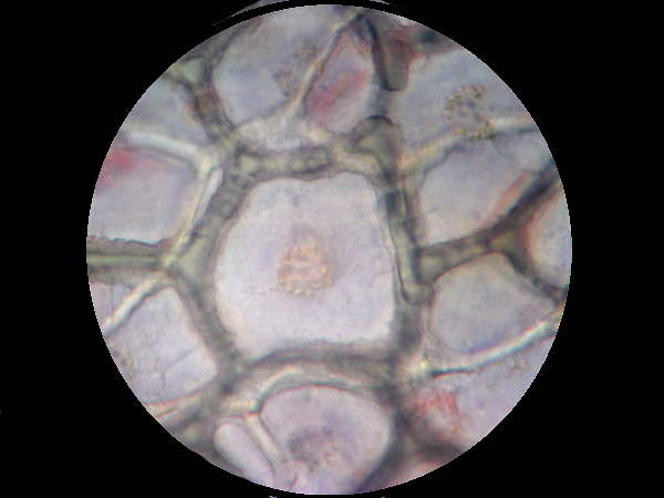 Клетка мякоти рябины. Клетки томата под микроскопом. Клетки мякоти томата. Клетка кожицы томата под микроскопом. Клетки мякоти яблока под микроскопом.